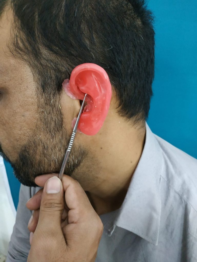 Wax Craving Trial | Chughtai Anaplastology