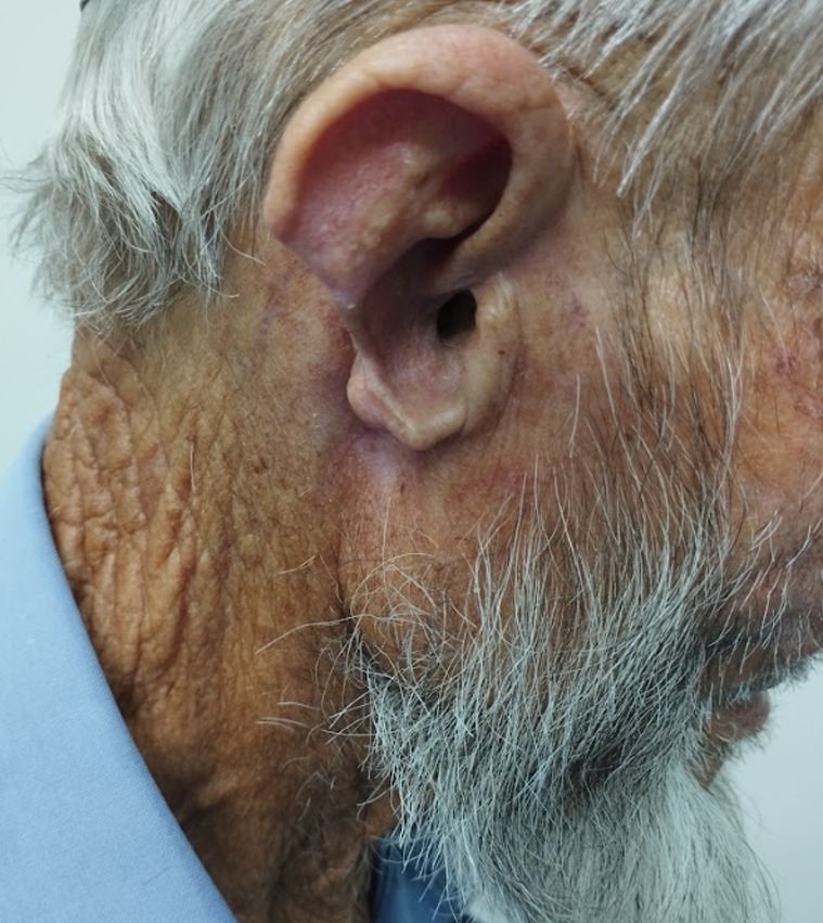 Ear, Nose, and Eye Prosthetics: How Anaplastology Restores Confidence and Quality of Life
