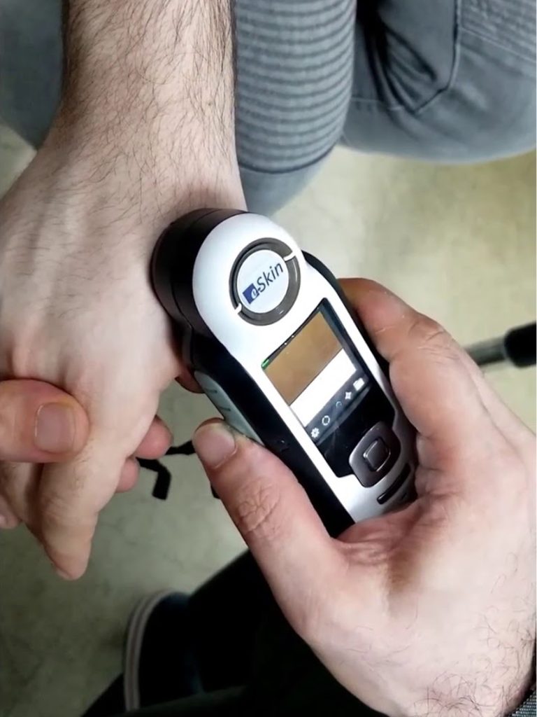 ESKIN Instrument for Prosthetics In Pakistan | Chughtai Anaplastology